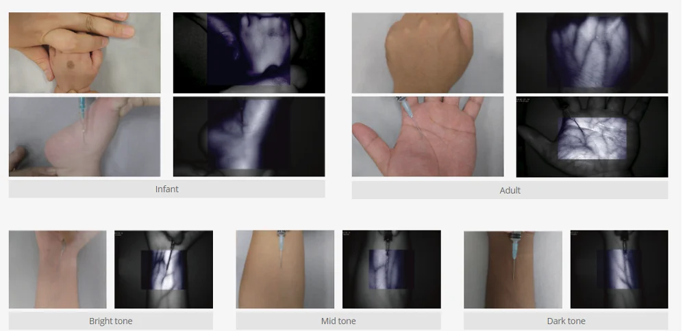 Projection Vein Detector with Images and Data Determination Demonstration and Analysis : SIFVEIN-1.2