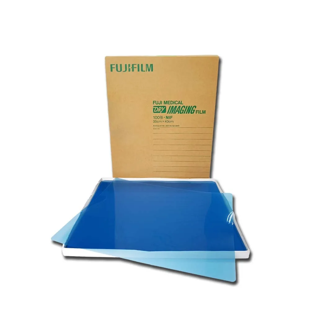 Thermal Fuji film is printed on Fuji thermal printer in the hospital