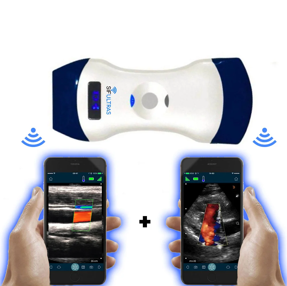 NEW portable color  double head  ultrasound convex & Linear for emergency:  SIFULTRAS-5.42