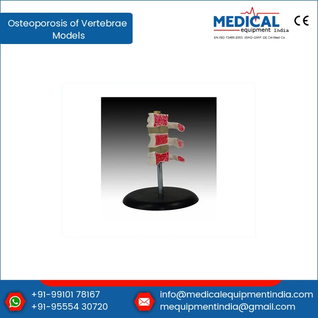 Eco Friendly PVC Material Osteoporosis Of Vertebrae Models Human Cutaway Osteoporosis Medical Training Model
