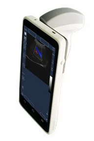 Android Medical Color Convex doppler With 6 Inch Full-Touch Screen 2-5 MHz 64 Elements, SIFULTRAS-2.0 for Clinic and Hospital