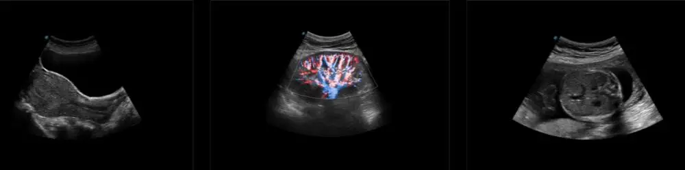 NEW Sonoscape P9 P10 P15 Doppler Trolley Ultrasound Device State-of-the-Art Electronic Equipment