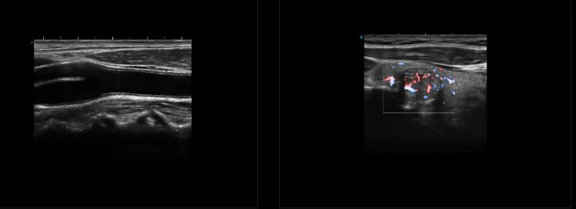 NEW Sonoscape P9 P10 P15 Doppler Trolley Ultrasound Device State-of-the-Art Electronic Equipment