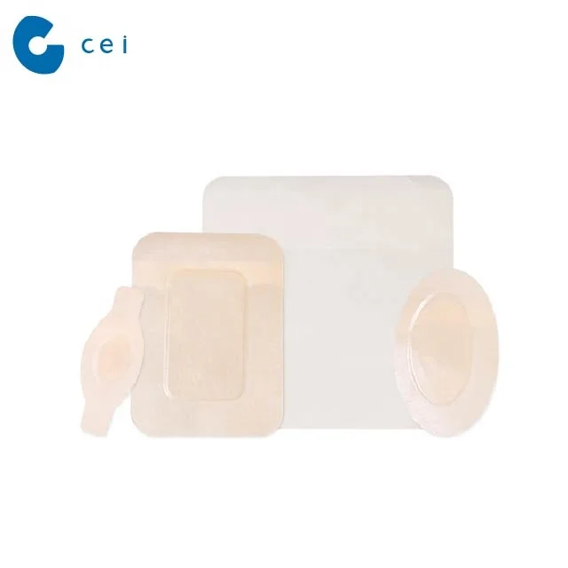 Medical Consumables Hydrocolloid Adhesive Tape Hydrocolloid Wound Dressing Medical Tape