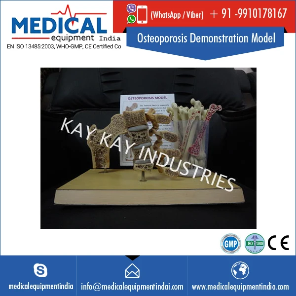 Excellent Cuts Osteoporosis Demonstration Model by medical equipment india