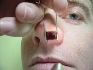 THUDICHUM NASAL SPECULUM HIGH QUALITY PAKISTAN  Mahersi