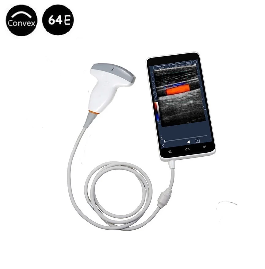 Android Medical Color Convex doppler With 6 Inch Full-Touch Screen 2-5 MHz 64 Elements, SIFULTRAS-2.0 for Clinic and Hospital