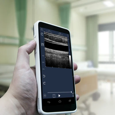 Android Medical Color Convex doppler With 6 Inch Full-Touch Screen 2-5 MHz 64 Elements, SIFULTRAS-2.0 for Clinic and Hospital