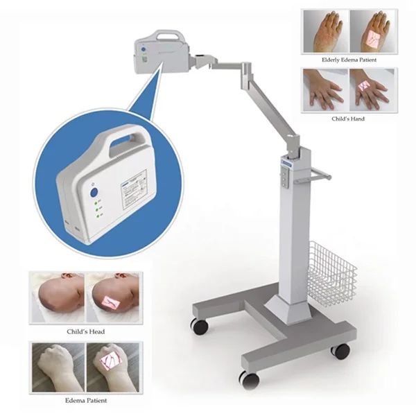 Analytical Arteries Veinal Detection Finder Viewer Device for Medical Aesthetic Procedures SIFVEIN-5.9