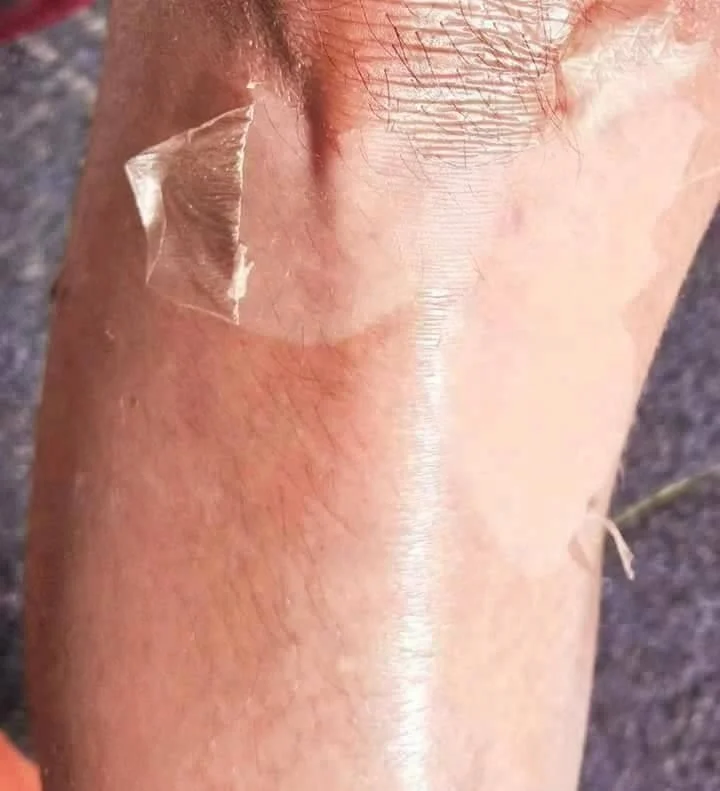 
Most Effective Yellow Peeling Oil 1 Liter Lowest Price 