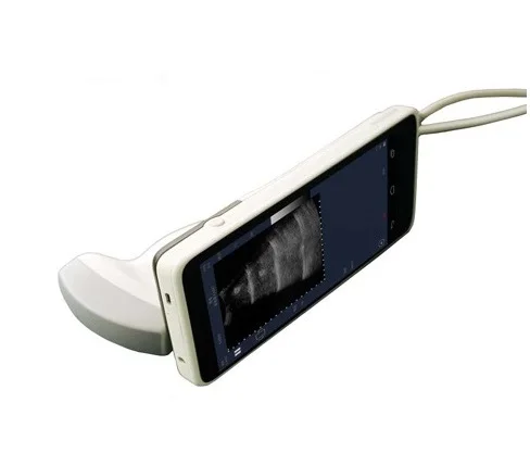Android Medical Color Convex doppler With 6 Inch Full-Touch Screen 2-5 MHz 64 Elements, SIFULTRAS-2.0 for Clinic and Hospital