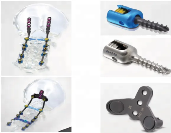 Fule spine implants spine fixation system, CFS system implants orthopaedic implants