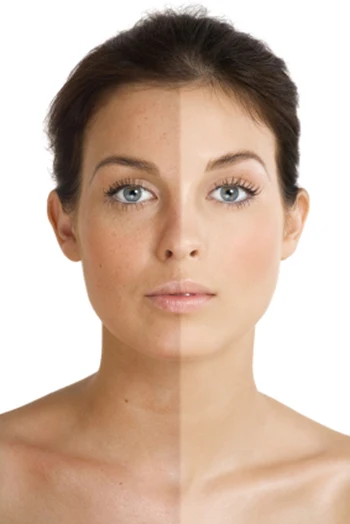 
Hyaluronic Acid 50% Serum Gel Concentrate 