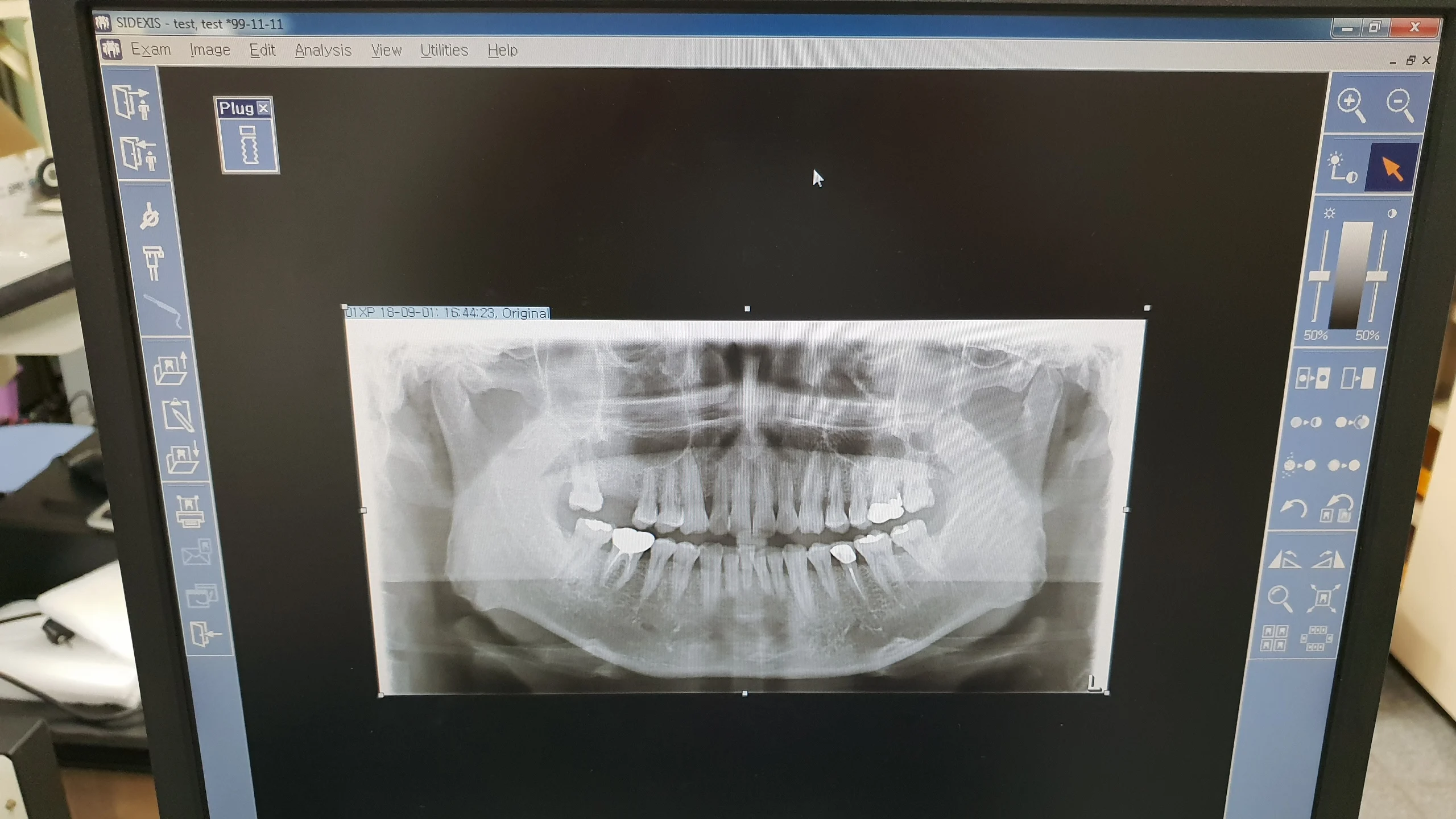 USED DIGITAL CT PANORAMIC DENTAL X-RAY SYSTEM w/wo CEPHALO UNIT