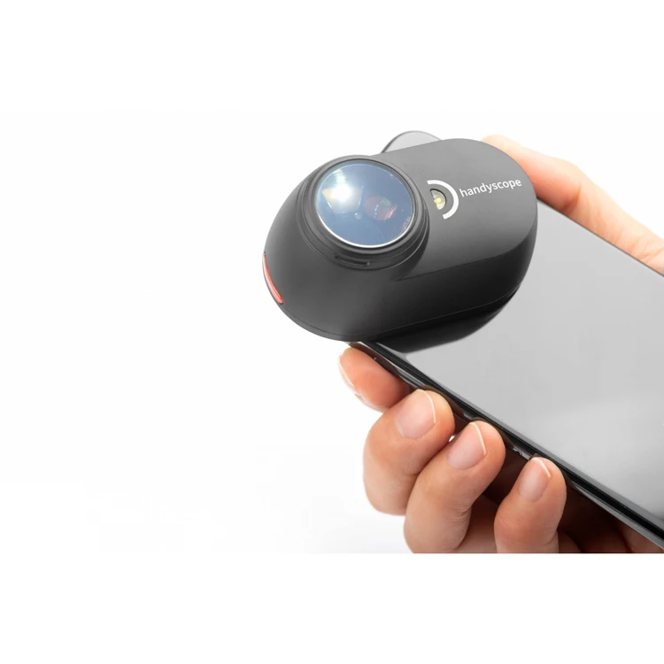 Best solution skin dermatoscope carry out diagnostics in any conditions price skin testing equipment checking analysis