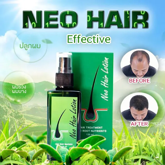 Neo Hair Lotion Hair Root nutrients advanced nutrients