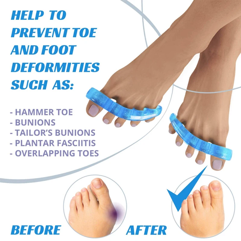 Toe Separators for Overlapping Toes  Bunion Corrector  Hammer Toe Separator