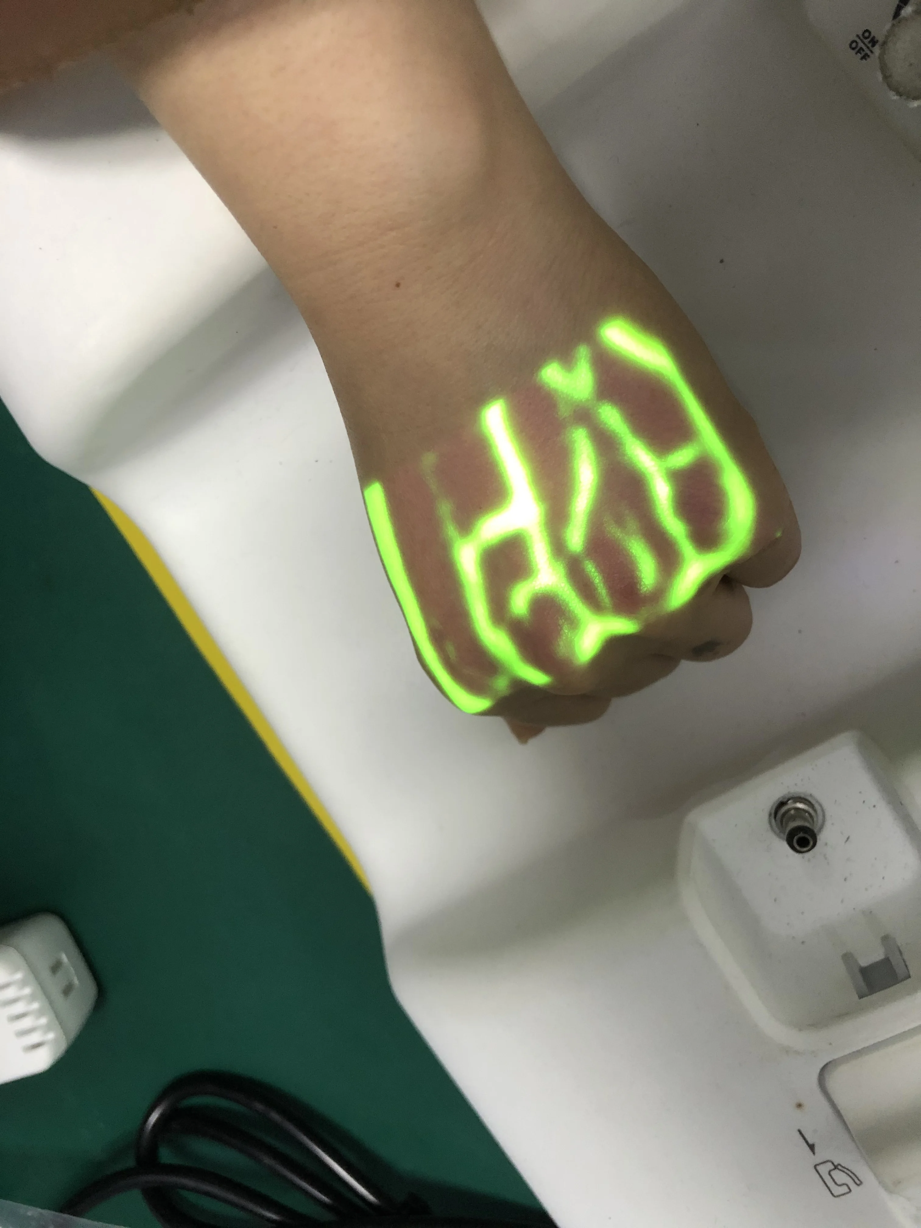 
cheap price US patent Biochemical projecting hospital Veinview 