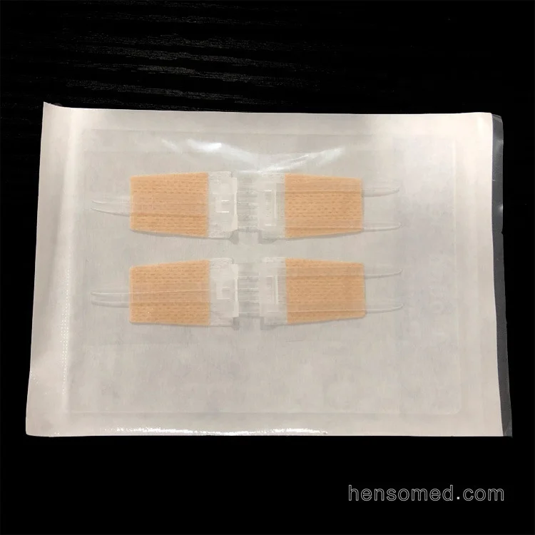 
Adhesive Wound Skin Closure Device 
