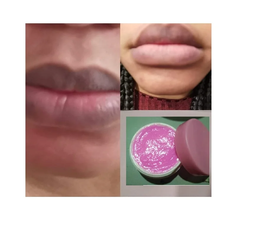 
Very Effective Pink Lips and Nipple Cream for Dark Lips Nipple Private Label 10g 