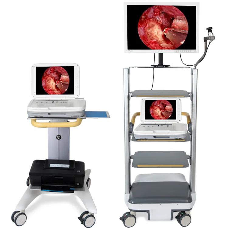 15 inch HD medical endoscope portable endoscope camera