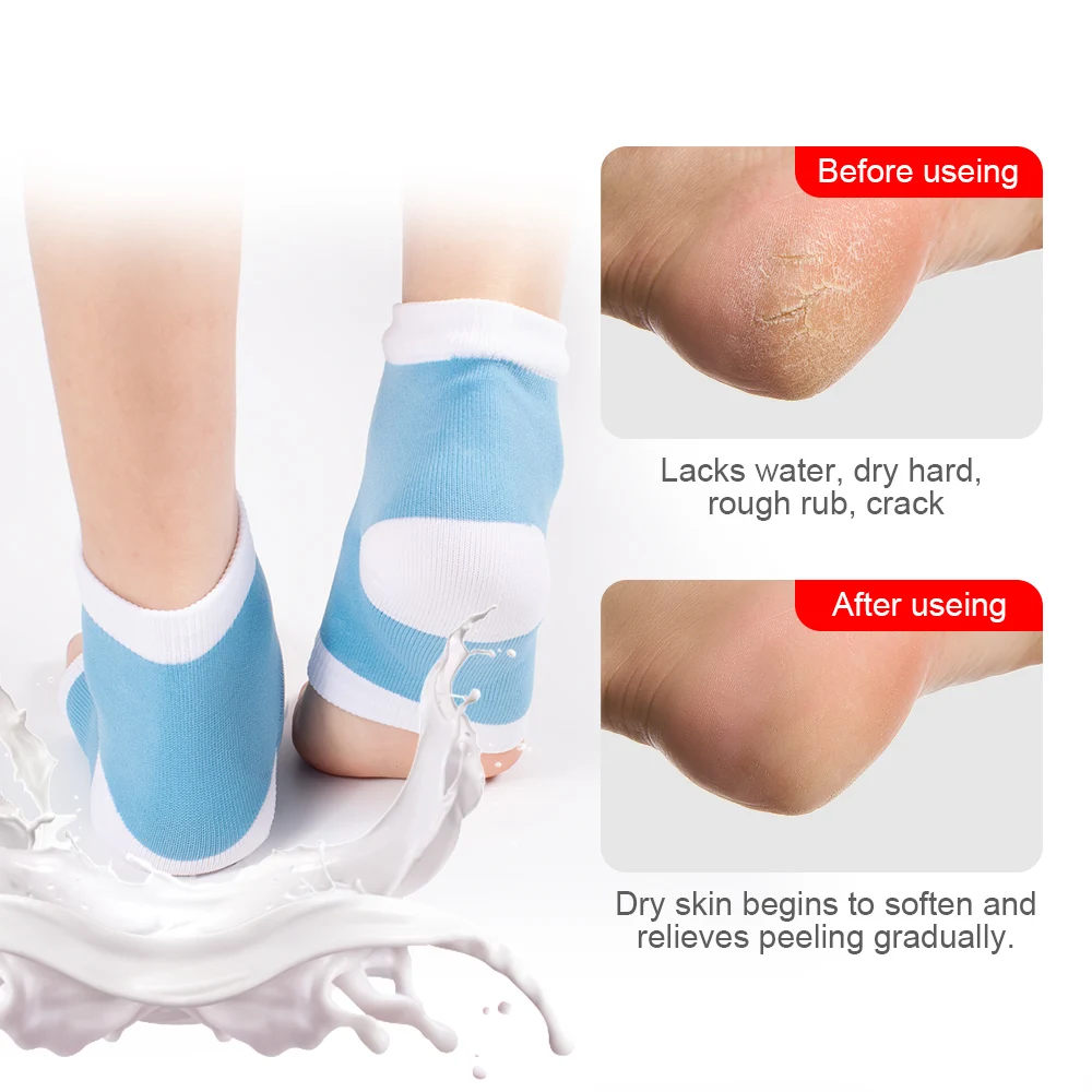 Moisturizing Socks Lotion Gel for Dry Cracked Heels ANKLE brace