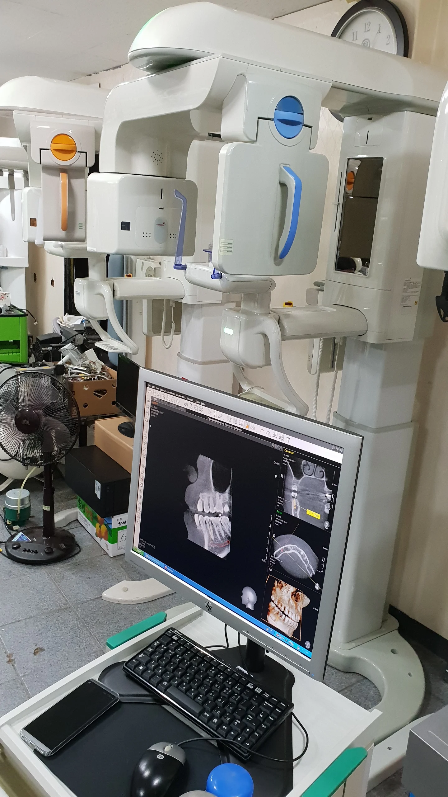 Б/у купите цифровой CT & панорамная зубоврачебная X-RAY системы w/wo cephalo