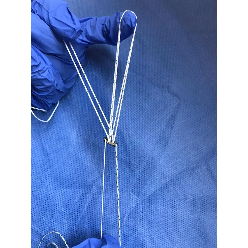 Американский ортопедический инструмент Biopower Endobutton высококачественное имплантационное оборудование