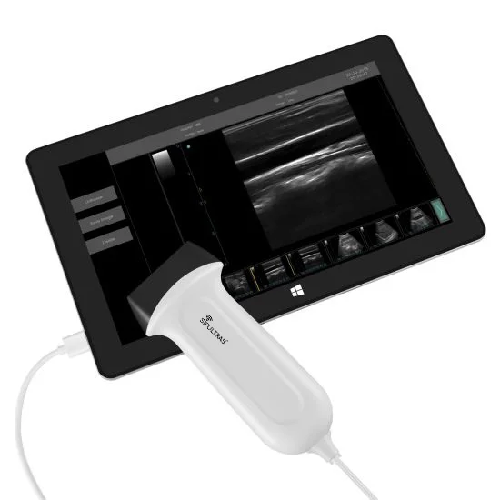 USB Linear 5-12MHz Ultrasound Scanner SIFULTRAS-9.53