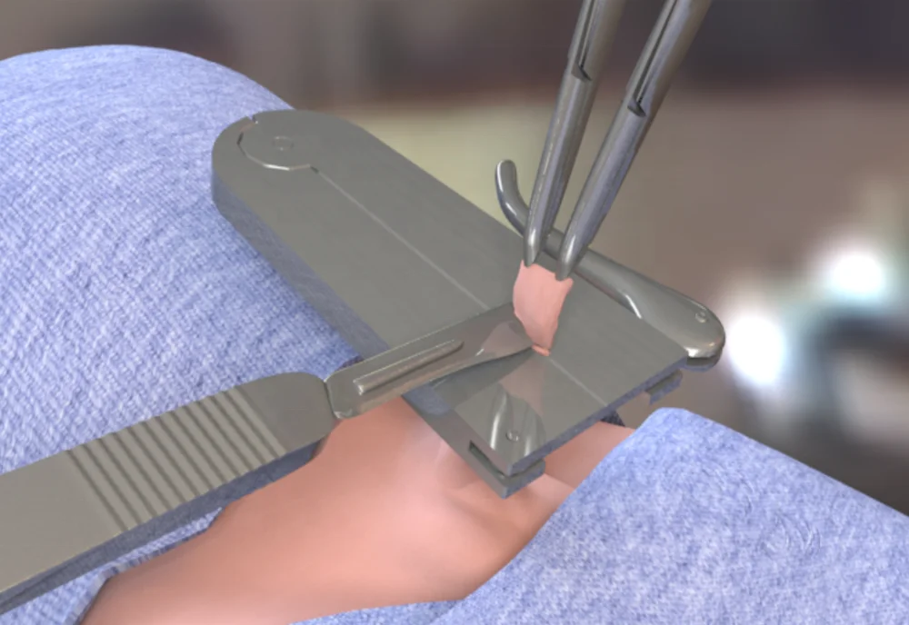 
Mogen Circumcision Clamp Surgical instruments Japanese Stainless steel 