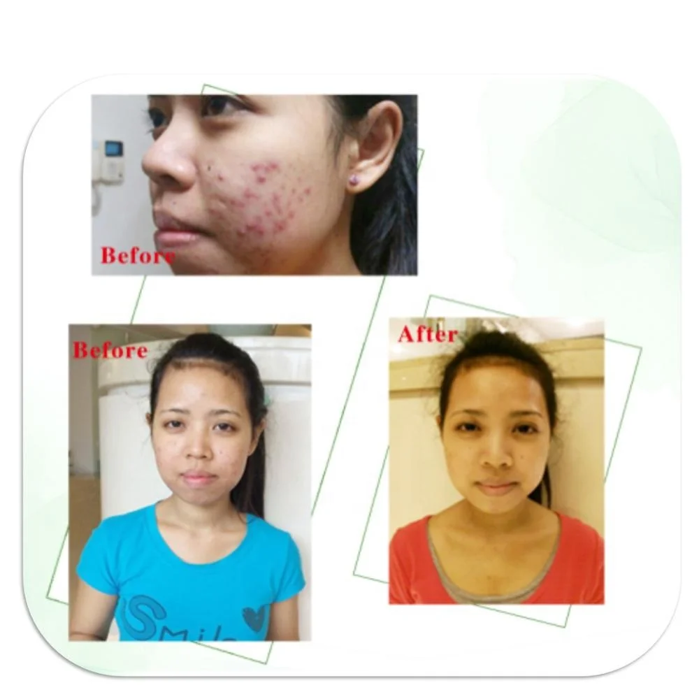 
Deep cleansing and anti sensitive mousse Facial Wash 