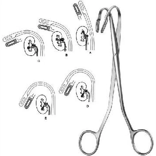 Камень для почек, каменные корзины, урология, специи, шлифовальный камень