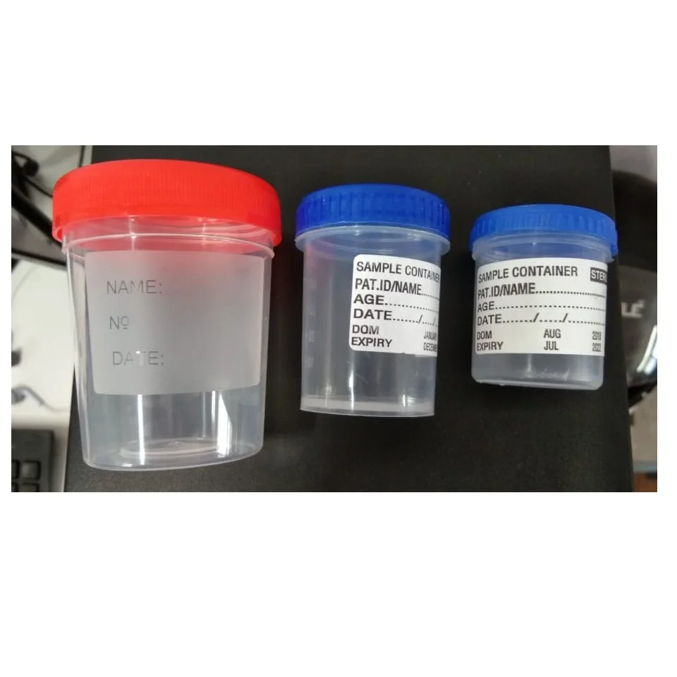 
urine cup Urine Container (Sterilized) 10ml, 20ml, 30ml, 50ml, 120mL.