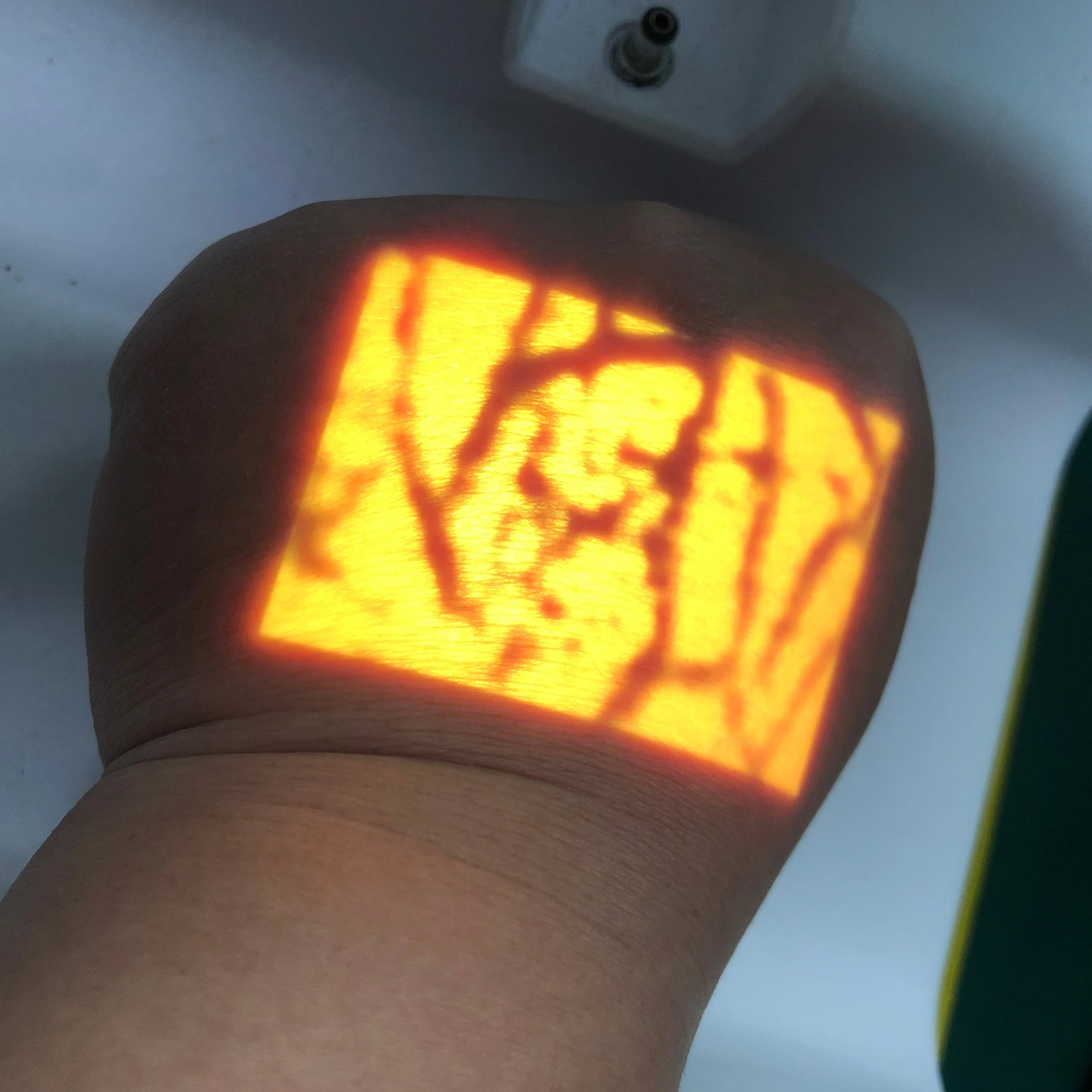 
cheap price US patent Biochemical projecting hospital Veinview 