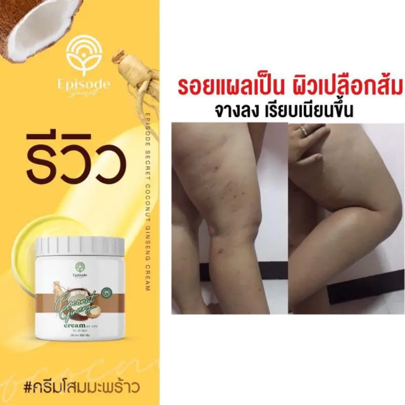 Ginseng Coconut Cream By EPS For All Skin (Say Goodbye To Damaged Skin Or Stretch Marks)
