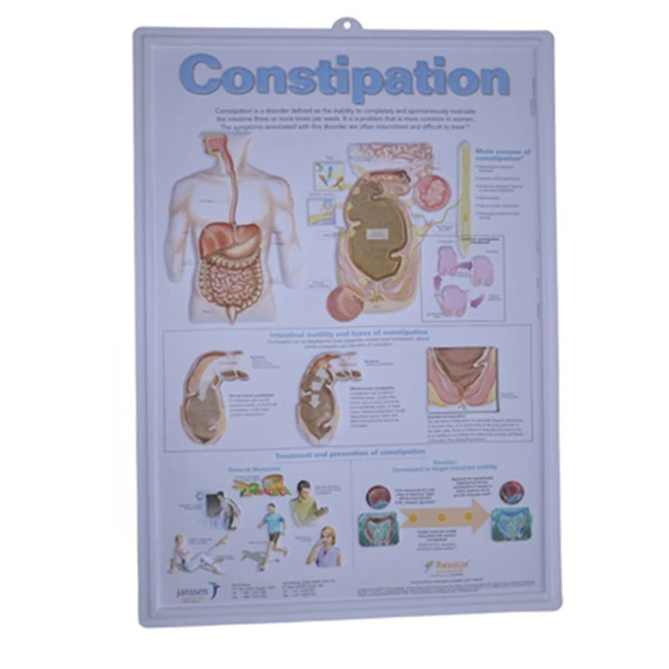 3D Medical Human Anatomy Heart Wall Charts  3d Heart Anatomy poster