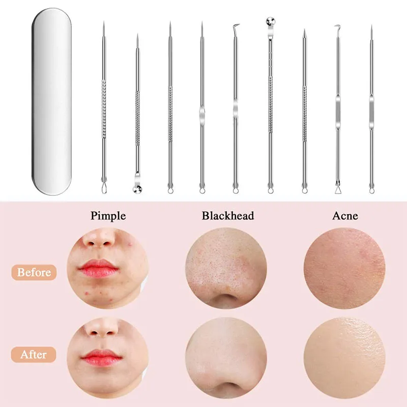 Жидкость для снятия экстрактор акне удаление инструмент моднок ювелирное изделие Popping Прыщ Пятна Zit удаления из нержавеющей стали комплект