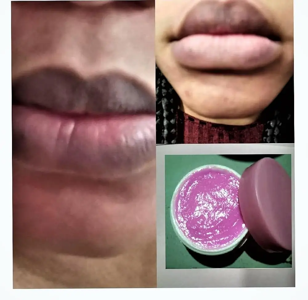 
Very Effective Pink Lips and Nipple Cream for Dark Lips Nipple Private Label 10g 
