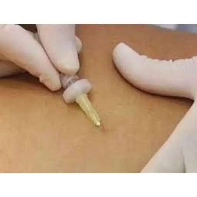 
Hot Sale! Medical CO2 Dosifier Machine Carboxy Therapy Now With CO2 Heater 