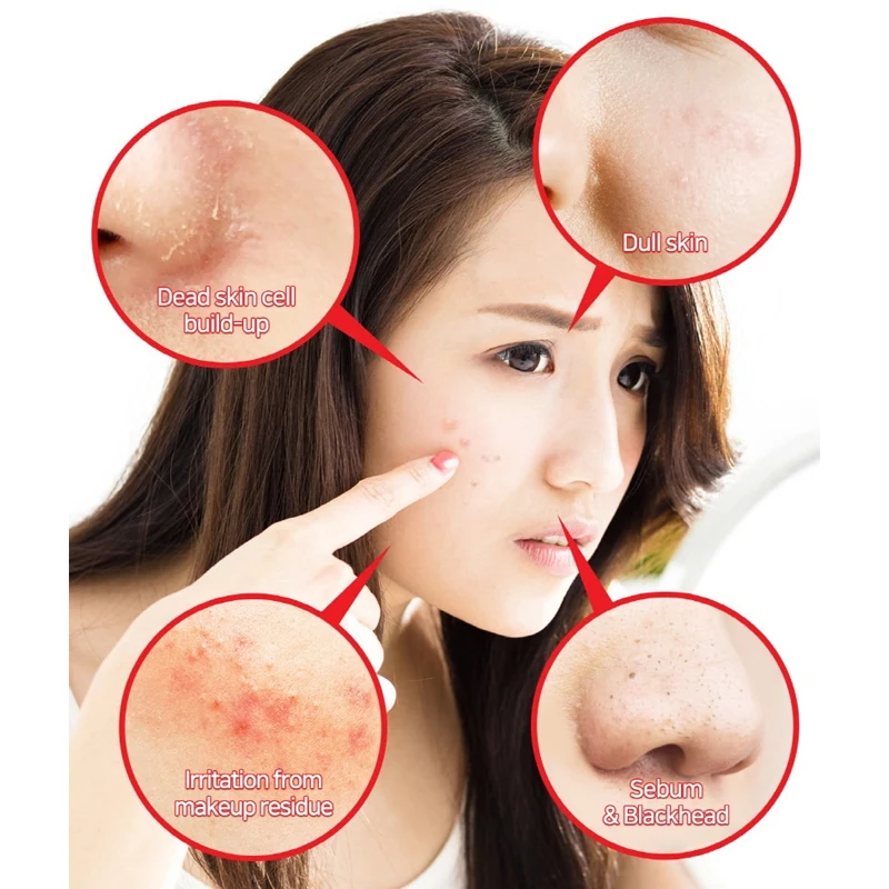 
[SomeByMi] AHA/BHA/PHA 30 DAYS MIRACLE SERUM 