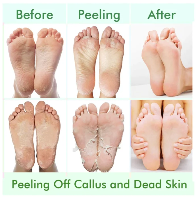 Korea OEM Hinoki Foot Peeling Mask foot peel spa socks exfoliating foot mask