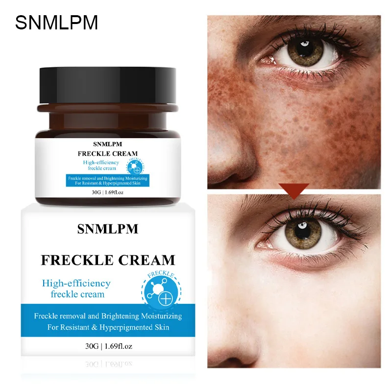 XBY 30Ml Hot Selling Freckle Melasma Removal Product High Quality Skin Whitening Cream Without Side Effects