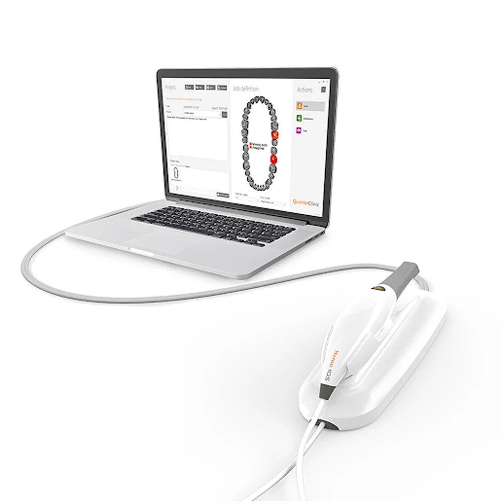 
 Heron Intraoral Scanner 3DISC Developed New and Innovative Technology Intraoral Scanner  