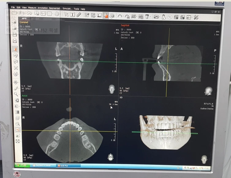 USED DIGITAL CT PANORAMIC DENTAL X-RAY SYSTEM VATECH w/wo CEPHALO UNIT