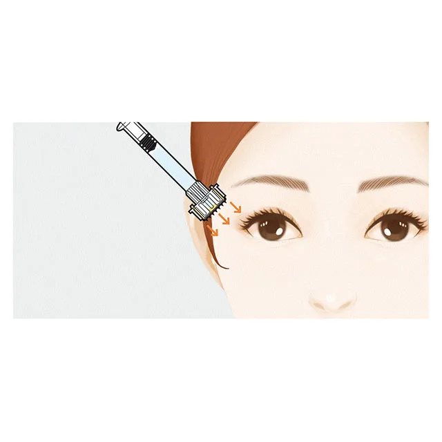  [MITI Systems] Safe and easy to use solid micro needle for hair face from south korea