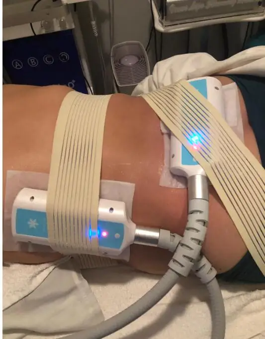 2021 hot sale 4 cryo handles weight loss machine cryolipolysis plate