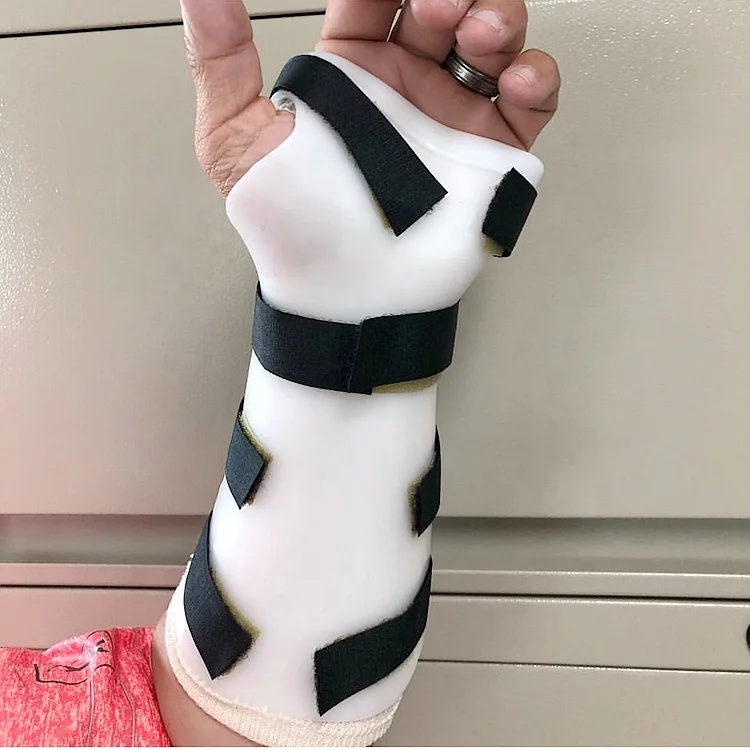 Orthopedic Fracture Splint hand splints Replace Plaster Bandage