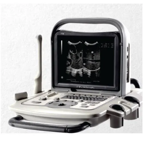 
 Полностью цифровая портативная ультразвуковая машина для больницы   (1600156055019)