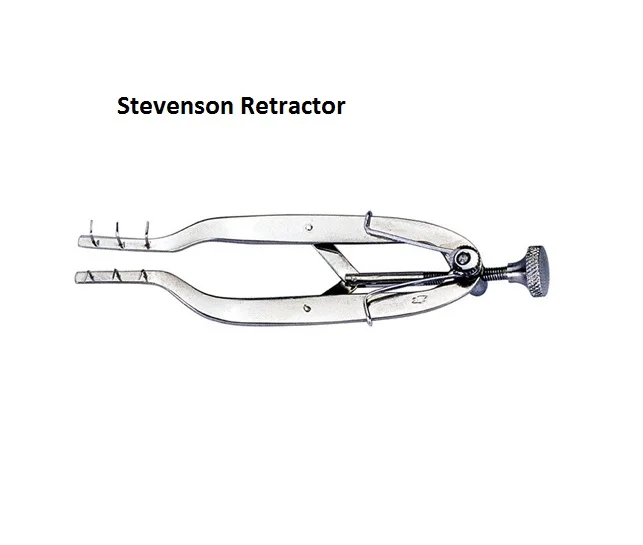 stevenson retract..jpg