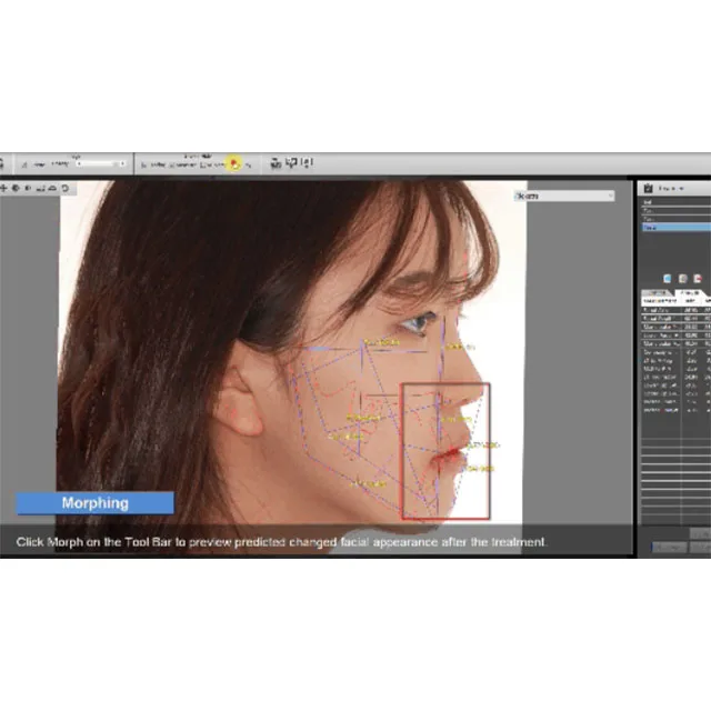 SmartCeph Korean Best Quality 2D cephalometric x-ray diagnosis